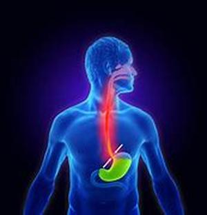 Acid Reflux