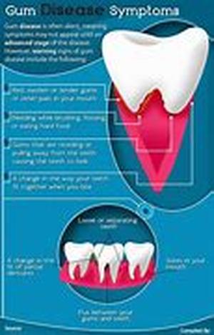 Several Studies Have Shown A Strong Connection Between Gum Disease And Heart Disease And How Proper Teeth And Gum Care Could Help Prevent Heart Attack
