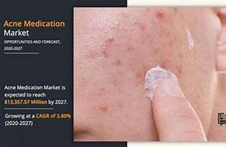 Acne: Common Illness May Be Increased By Usage of Antibiotics for Acne