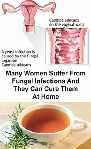 Home Remedies For Shingles