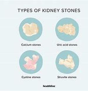 Calcium Gluconate