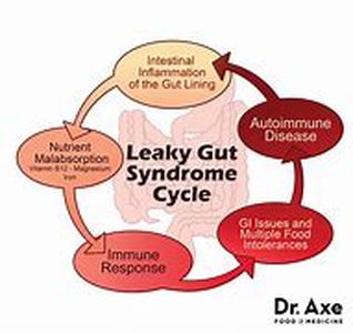 What is a Myocardial Infarction