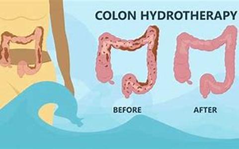 Colon cleansing