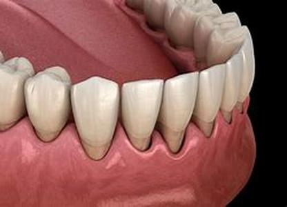 Causes And Cures For Snoring Snoring Is Present In Almost Half Of The Adult Population Of The World