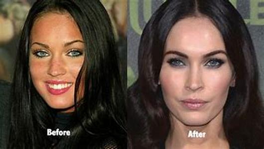 Plastic Surgery vs