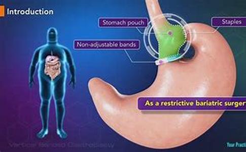 Lose Belly Fat Now