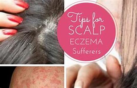 How To Avoid Hoodia Diet Pill Scams