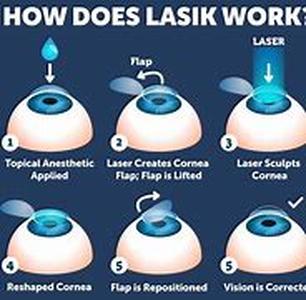 Lasik Lose Those Glasses For Good