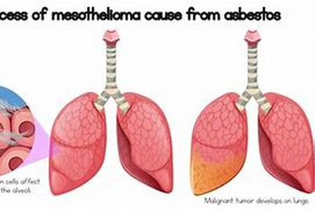 Asbestos Education Due To The Fire- Resistant Facet Of The Fibrous Mineral, The Romans In The Middle Ages Were Deeply Fascinated That They Applied It As A Border To Their Armors For Battle