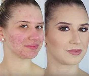Finding Effective Skin Care Products
