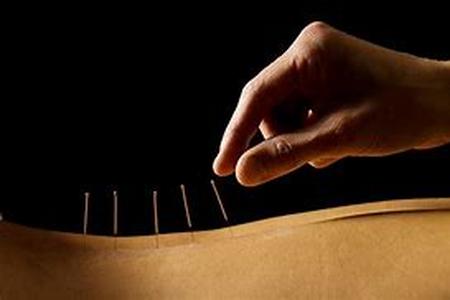 Acupuncture For High Blood Pressure  A New Treatment That Works