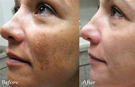Skin Deep: The Psychology Behind Plastic Surgery