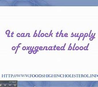 Keyword phrase  Cholesterol Lowering Foods