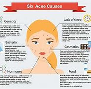 Acne Rosacea Skin Care  The first sound of its name may bring you to stop for a while because it is simply scientific in nature