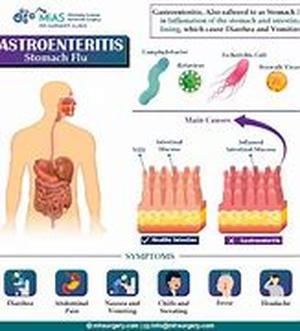 Gastric Bypass - The Response To A Man-Made Problem
