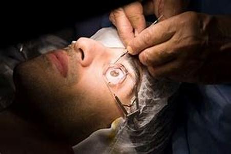 Lasik Eye Surgery: Is It Right For You
