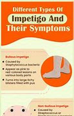Spotting the Signs of Anorexia