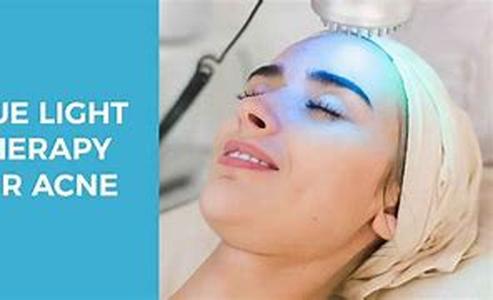 The Acne and Diet Connection