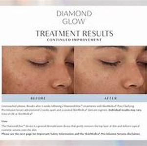 Facial Flaws