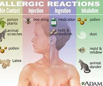 Allergies - Antihistamines and How They Work