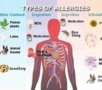 Allergies