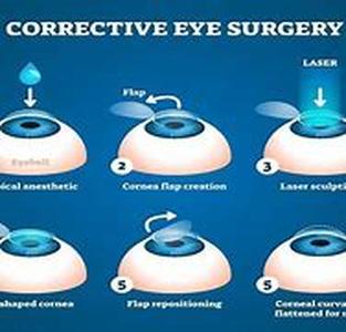 LASIK MD - How To Find The Right Doctor
