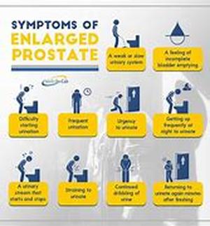 Prostate Cancer  Probably one of the most feared among the diseases is the Big C or commonly known as cancer