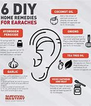 Home Remedies For Bloodshot Eyes