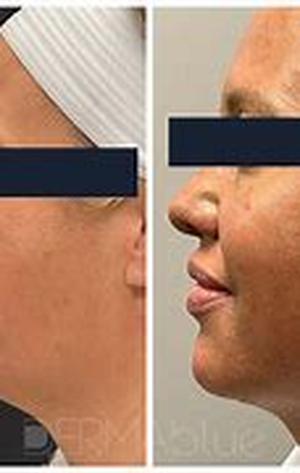 How Stress Can Make You Fat
