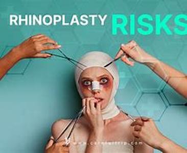 Rhinoplasty in Beverly Hills