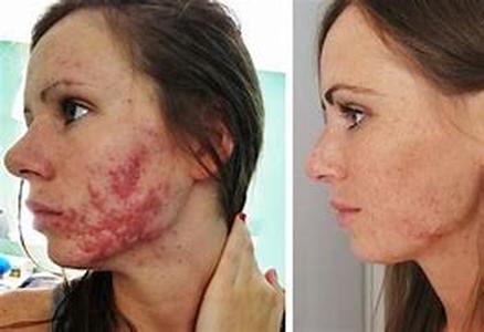 Abusive Relationships: Leave and Re-live
