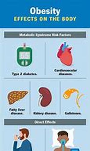 Key Words: obesity surgery