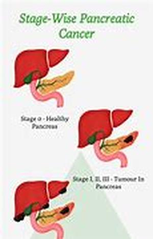 Organic heart disease  Summary: Organic heart disease is when your heart is deformed or inflamed