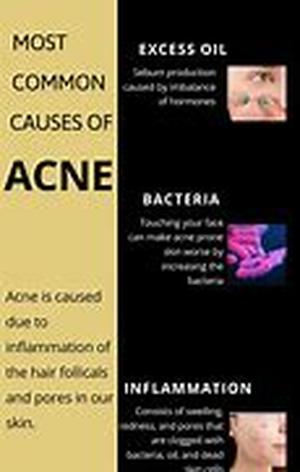 Common Aromatherapy Uses