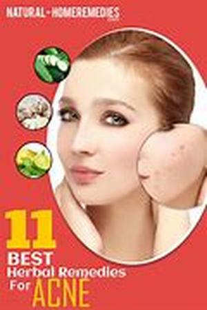 Herbal Dietary Supplements and Their Benefits
