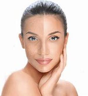 Agel UMI: A Highly Effective Way of Boosting Our All Important Immune System
