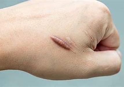 Skin Disorders and Cosmetics