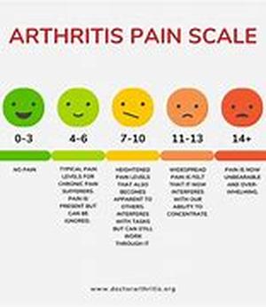 Arthritis Treatment