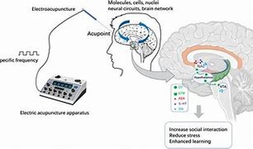 Abdominal Migraines
