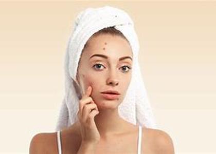Skin Care- An Overview Of Treatments For Excess Perspiration