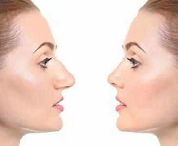 Science Of Acne In Layman's Terms