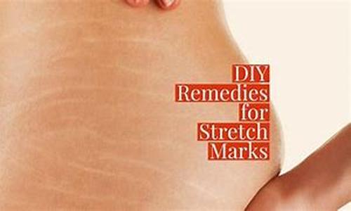Stretching your way to Health