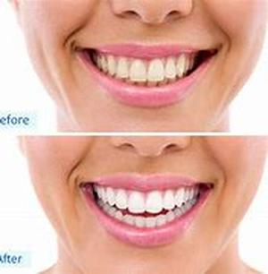 Cosmetic Tattoo Procedure for Permanent Eyebrows