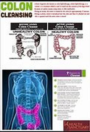 Colon Cancer and Colon Cancer Prevention