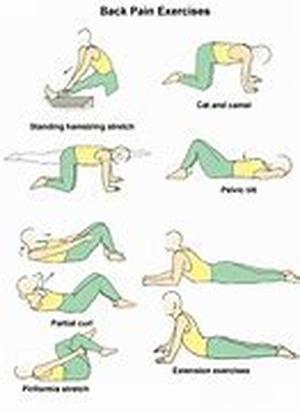 Backpain And ESI (Epidural Steroid Injection)