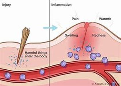Arthritis Pain Reliever