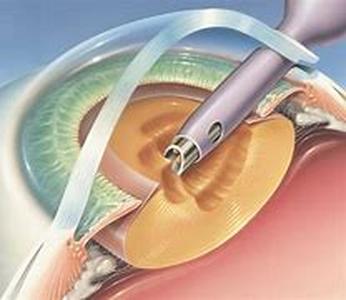 Affordable Ways to Seek Allergy Relief