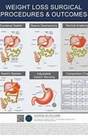 Weight Loss Diary, Day 1