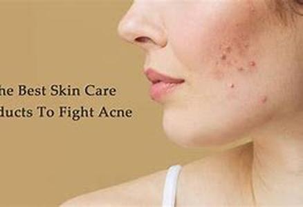 Acne: Fact And Fiction