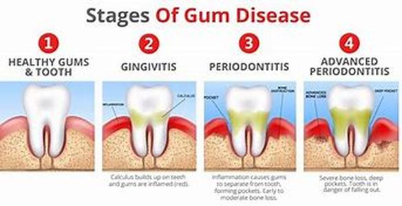 The Smell of Bad Breath  Known by many as halitosis, bad breath is a common condition that affects millions of people from different walks of life